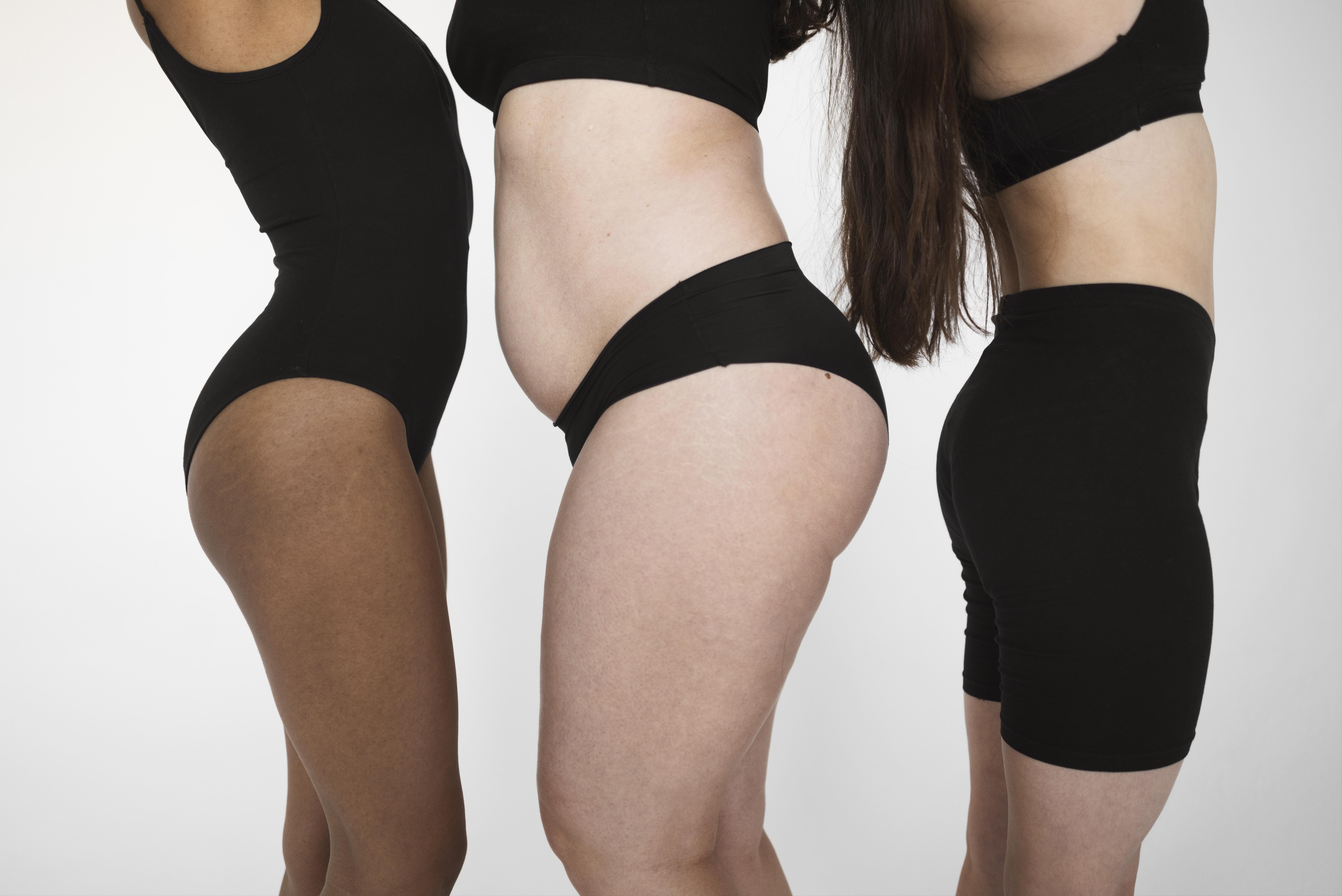       
          Liposuction – Safe Body Contouring with Natural Results
      
